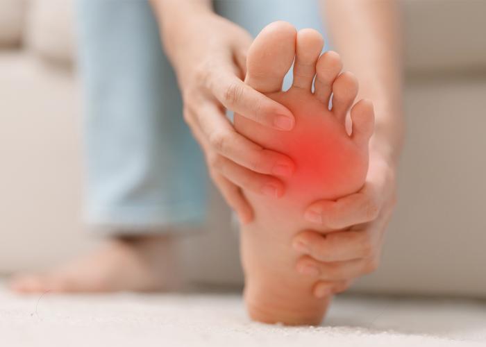 Arch Pain
