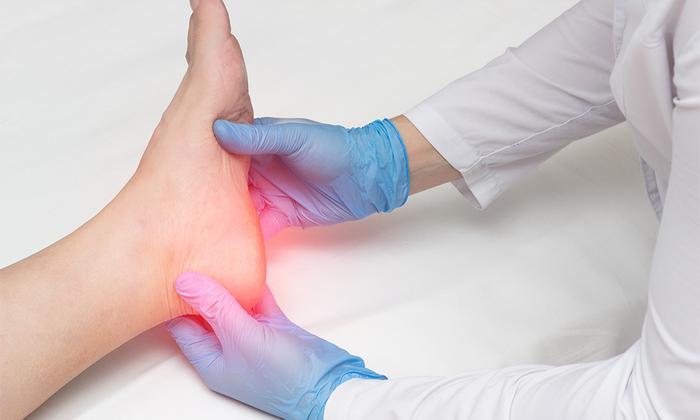Plantar Fasciitis